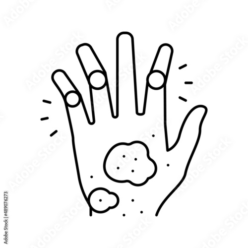 psoriatic arthritis skin health problem line icon vector illustration