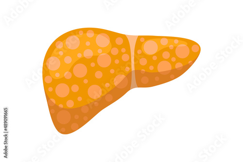 Sick unhealthy liver with jaundice or hepatitis. Human exocrine gland organ destruction concept. Vector hepatic eps illustration photo