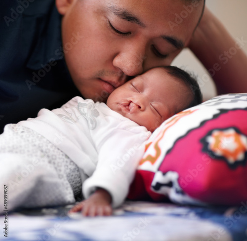 Under the loving gaze of his father. Shot of a young father bonding with his baby girl who has a cleft palate.