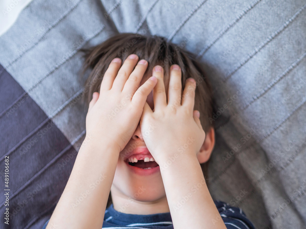 Laughing kid closes eyes with hands but shows hole in row of teeth in his mouth. One incisor fell out just now. Close up photo of gums for dentist. Laughing kid closes eyes with hands but shows hole in row of teeth in his mouth. One incisor fell out just now. Close up photo of gums for dentist.