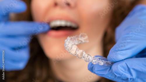 Orthodontist doctor putting silicone invisible transparent braces on woman teeth photo