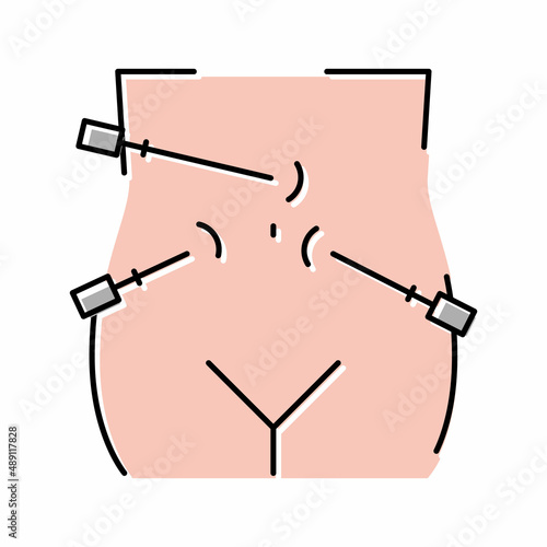 laparoscopy bariatric color icon vector illustration