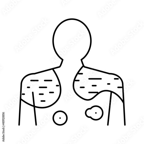 psoriasis disease line icon vector illustration