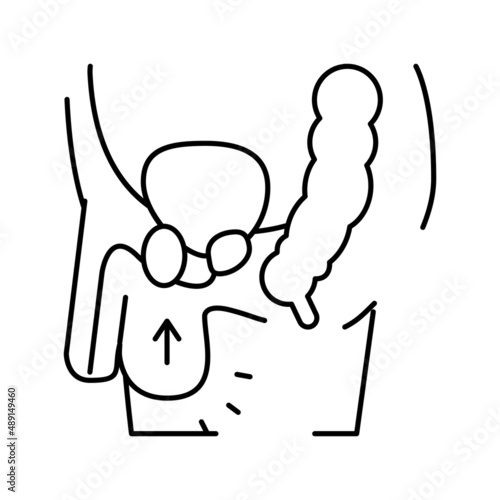 cryptorchidism disease line icon vector illustration