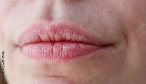 Close-up of woman's dry lips and skin with enlarged pores for cosmetic purposes