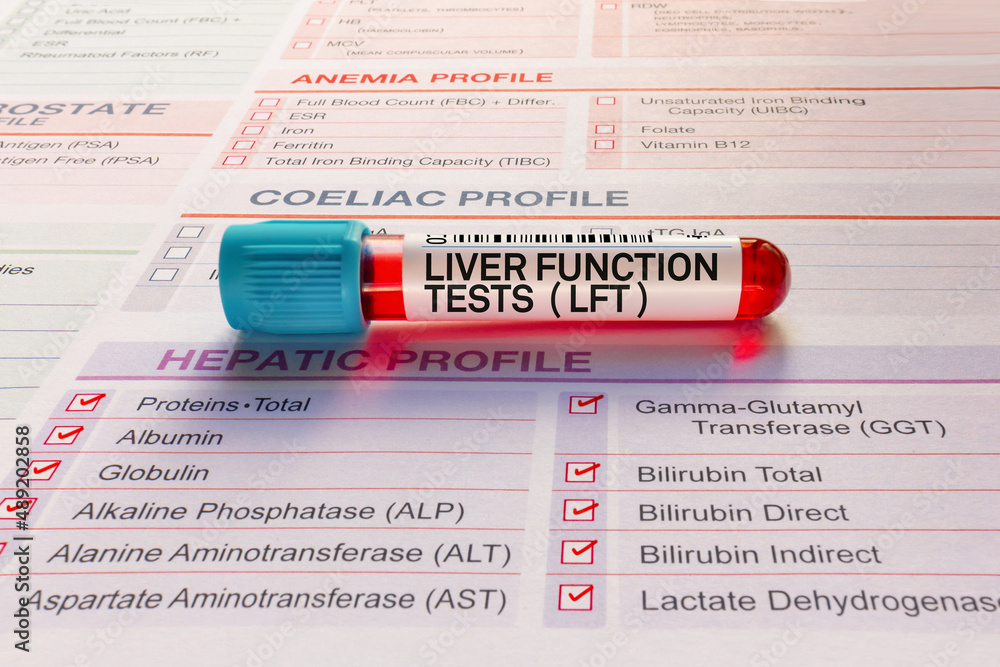 Liver analysis. Liver analysis. макет печени. Liver viscer. печень 3д модель.