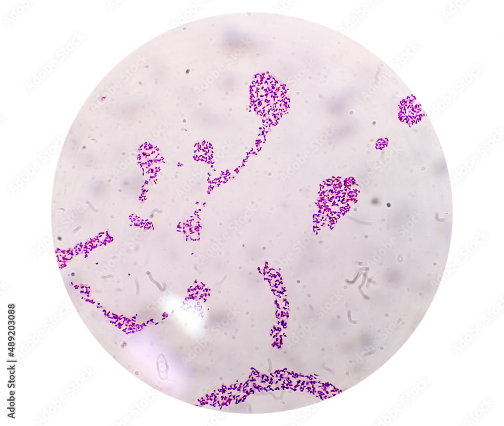 Blood agar bacterial colonies gram stained microscopic show Salmonella