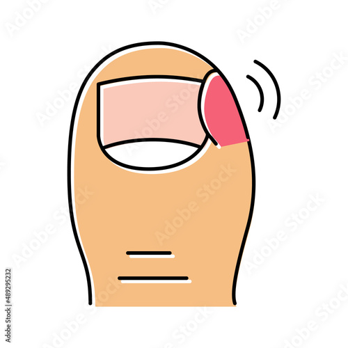 ingrown nail pain color icon vector illustration