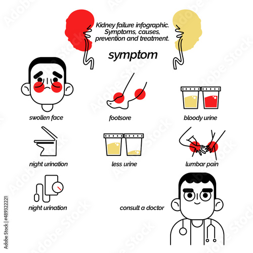 Kidney failure infographic. Symptoms, causes, prevention and treatment. 