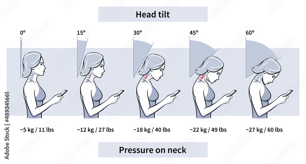 Load on neck and back when posture tilting head with phone, pain of weight, outline. Angle of bending head related to pressure on spine. Stage text neck syndrome. Vector illustration - obrazy, fototapety, plakaty 