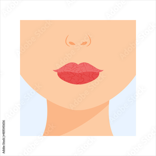 Fotografie Beautiful Dry lips