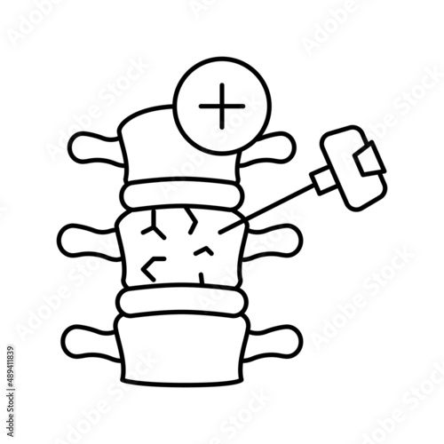 vertebroplasty and kyphoplasty line icon vector illustration
