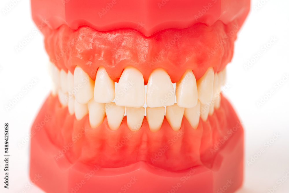 Obraz premium Closeup model with white teeth. Jaw in dentistry. Clean denture, model of the jaw. Dental, oral surgery, stomatology, orthodontist concept