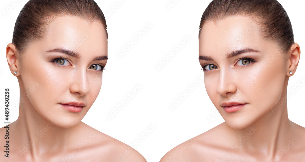 Young woman before and after chin correction. Over white background. Young woman before and after chin correction. Over white background.