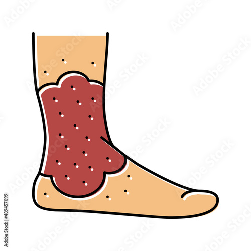 stasis dermatitis color icon vector illustration