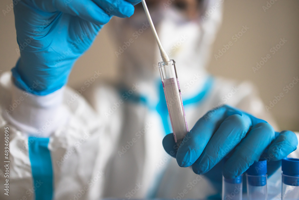 Naklejka process of coronavirus PCR antigen testing examination by