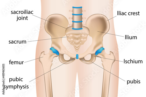  illustration of painful hip sacral inflammation, hip pain bursitis, arthritis