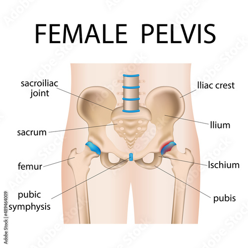 illustration of painful hip sacral inflammation, hip pain bursitis, arthritis