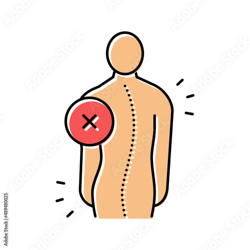 idiopathic scoliosis color icon vector illustration