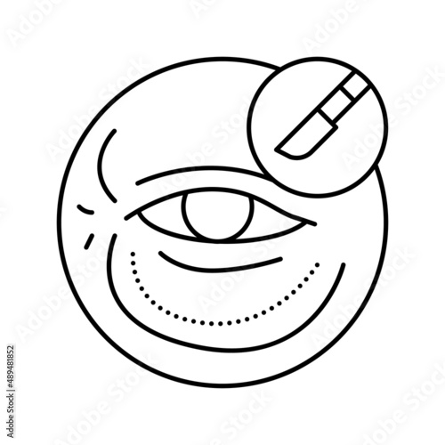 blepharoplasty surgery line icon vector illustration