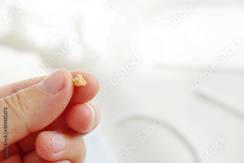 left hand holding a Tonsils stone or Tonsillolith on white background with copy space. photo
