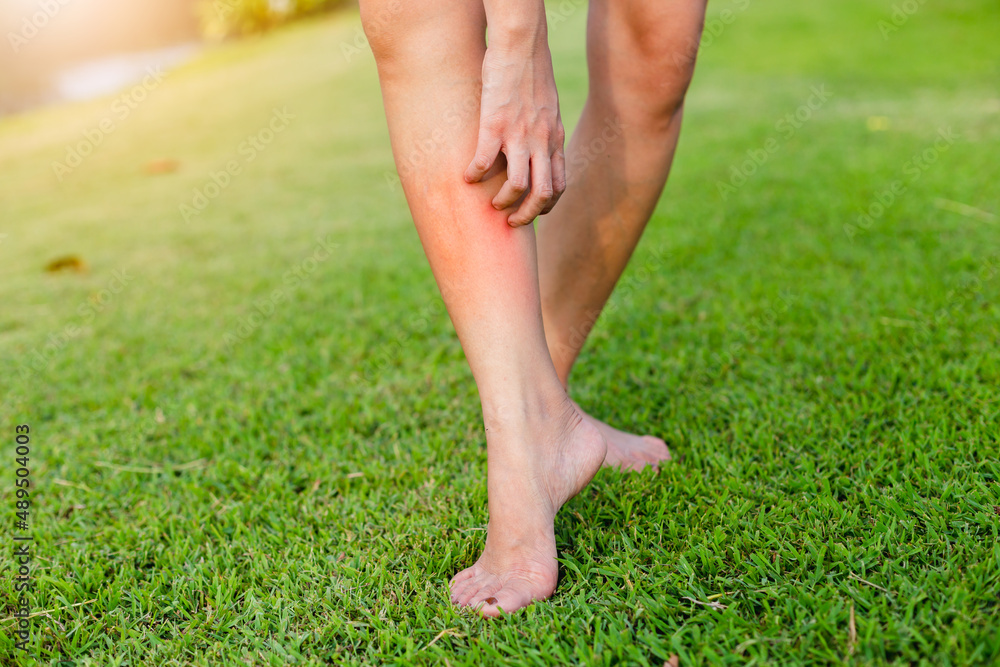 Women with his feet, itching on the lawn caused by insect bites and