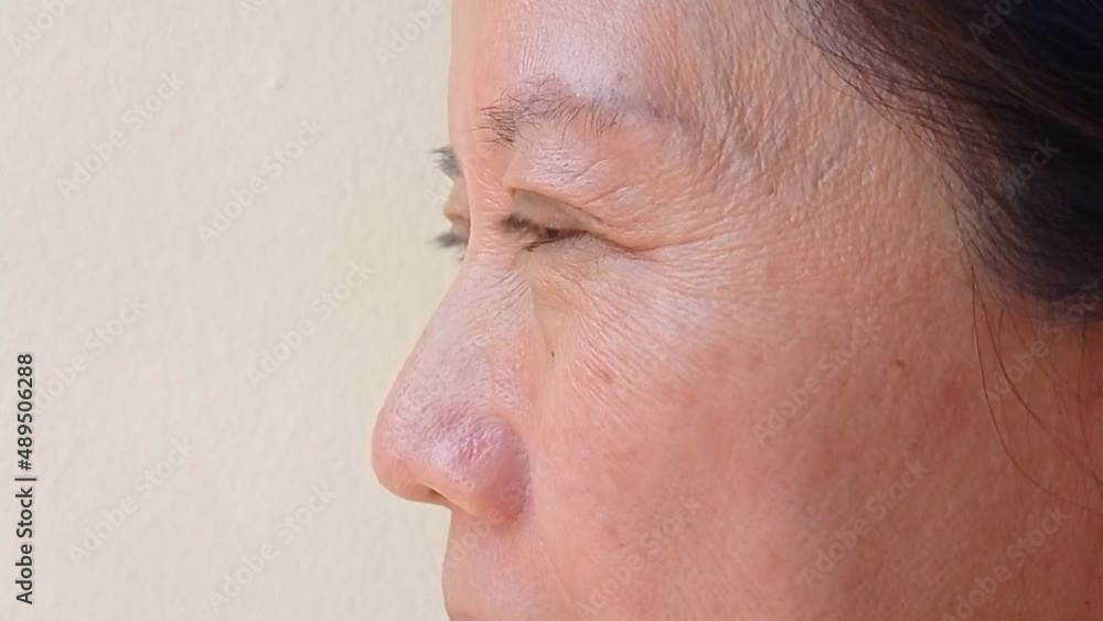 The corner of the woman's eye has wrinkles. The corner of the woman's eye has wrinkles.