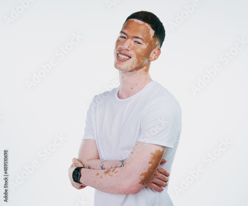 Love the skin youre in. Portrait shot of a handsome young man with vitiligo posing with his arms folded on a white background. photo