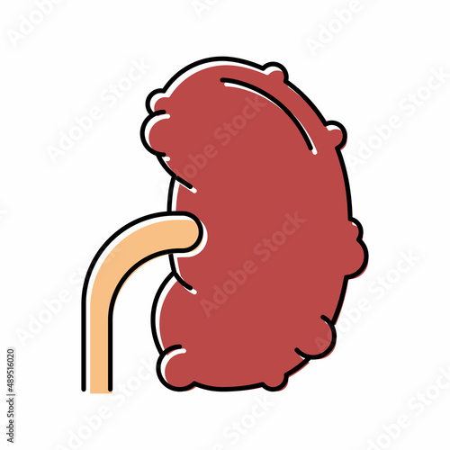 chronic pyelonephritis color icon vector illustration