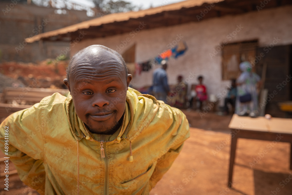 Portrait of an african man with Down syndrome is in an African village.  Stock Photo