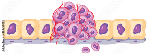 Isolated cancer cell on white background