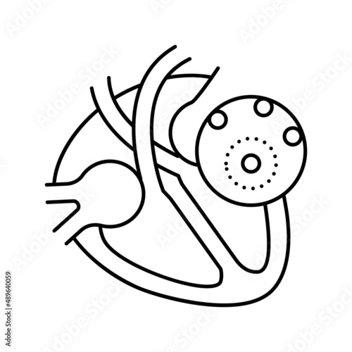 myocarditis disease line icon vector illustration