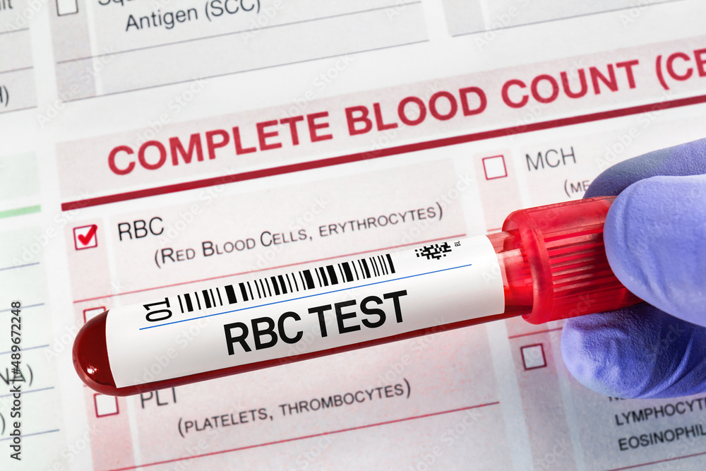 Blood tube test with requisition form for RBC Complete Red Blood Cells