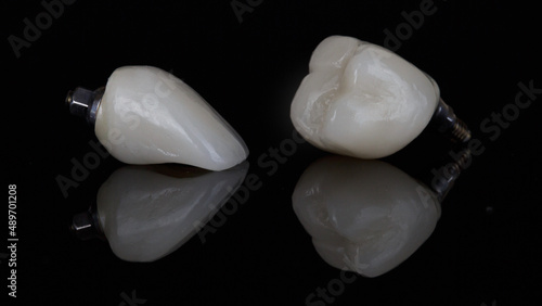 two beautiful dental crowns of the chewing and front teeth on black glass with reflection