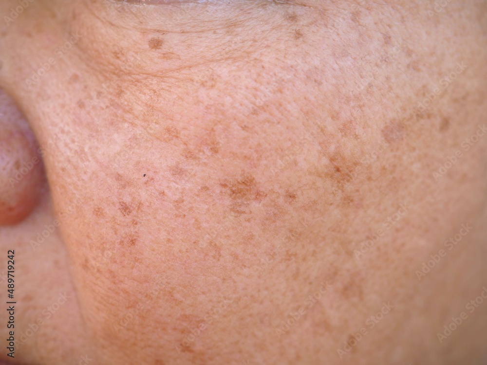 Problem skincare and health concept. wrinkles, dark spots, freckles, on face middle age woman. closeup photo, blurred. Problem skincare and health concept. wrinkles, dark spots, freckles, on face middle age woman. closeup photo, blurred.
