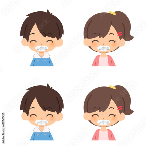 歯列矯正をする子供たち