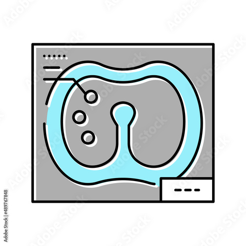larynx x-ray color icon vector illustration