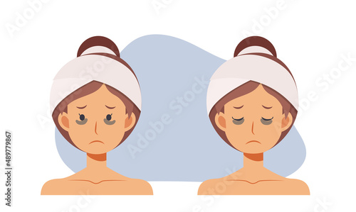 Skin care,beauty concept illustration. woman with dark circles on face. woman worried about dark circles.Flat vector cartoon character illustration.