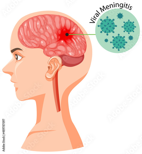 Human head section with brain