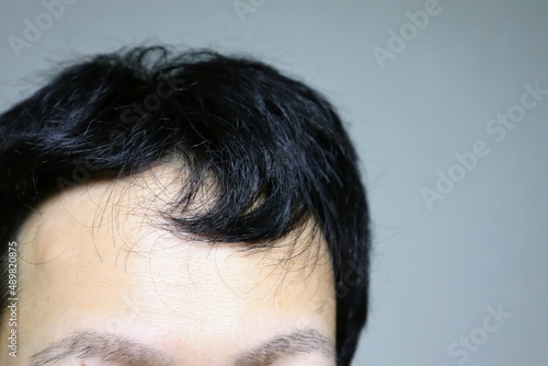 薄毛の日本人男性