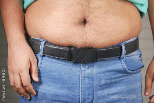  man with excessive belly fat, overweight concept