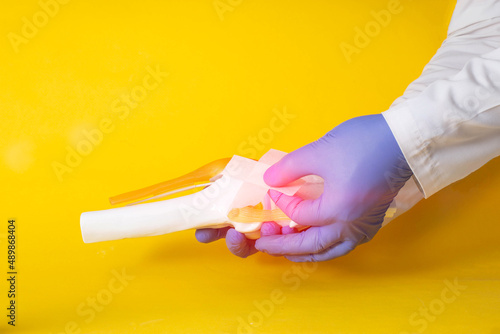 Doctor's hands gluing a medical plaster on a model of a sore knee joint, yellow background. Knee pain concept, synovitis and bursitis treatment, chlamydia. Copy space for text photo