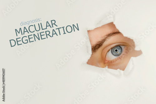 Macular degeneration disease poster with eye test chart and blue eye. Studio grey background photo