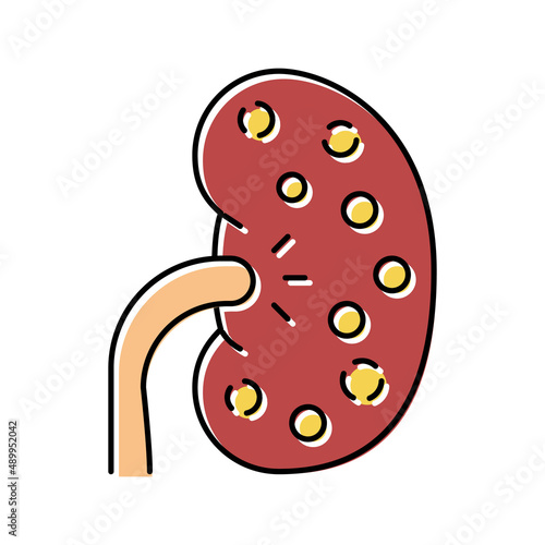 nephritis kidney color icon vector illustration