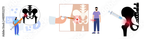 Hip joint injection photo