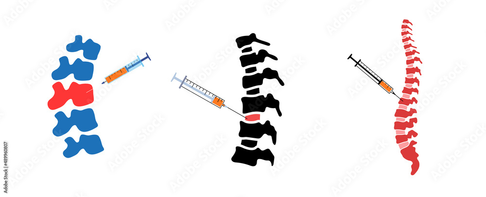 Spine injection concept Stock Vector | Adobe Stock