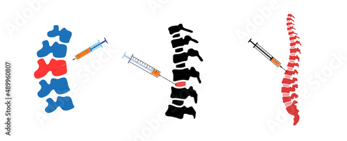 Spine injection concept