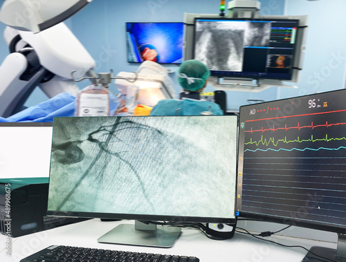 Coronary angiogram (CAG) on LCD monitor and Blurred of modern Cath Lab with the doctor, nurse, and patient in the operating room background