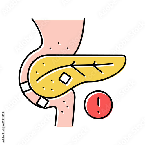 stones in pancreas color icon vector illustration