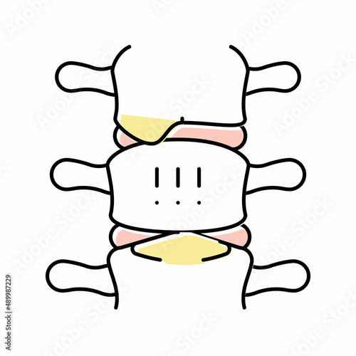ankylosing spondylitis color icon vector illustration